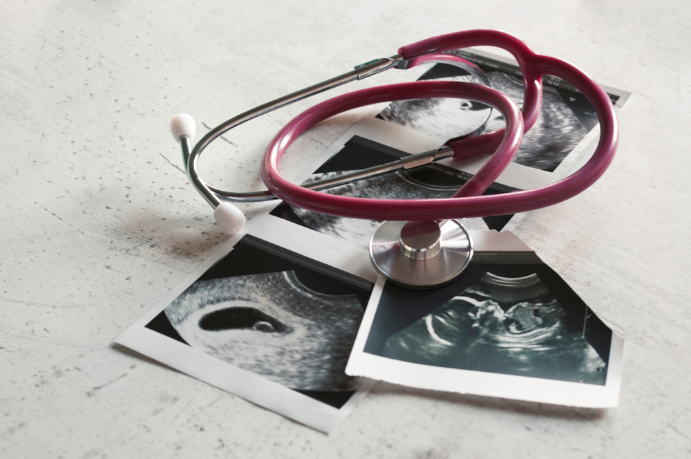 Crna-Gora-Selektivni-abortusi-i-dalje-prisutni